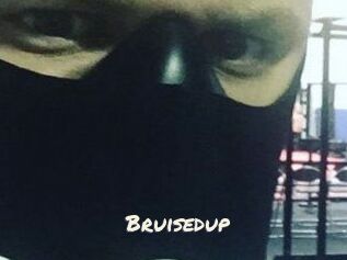 Bruisedup